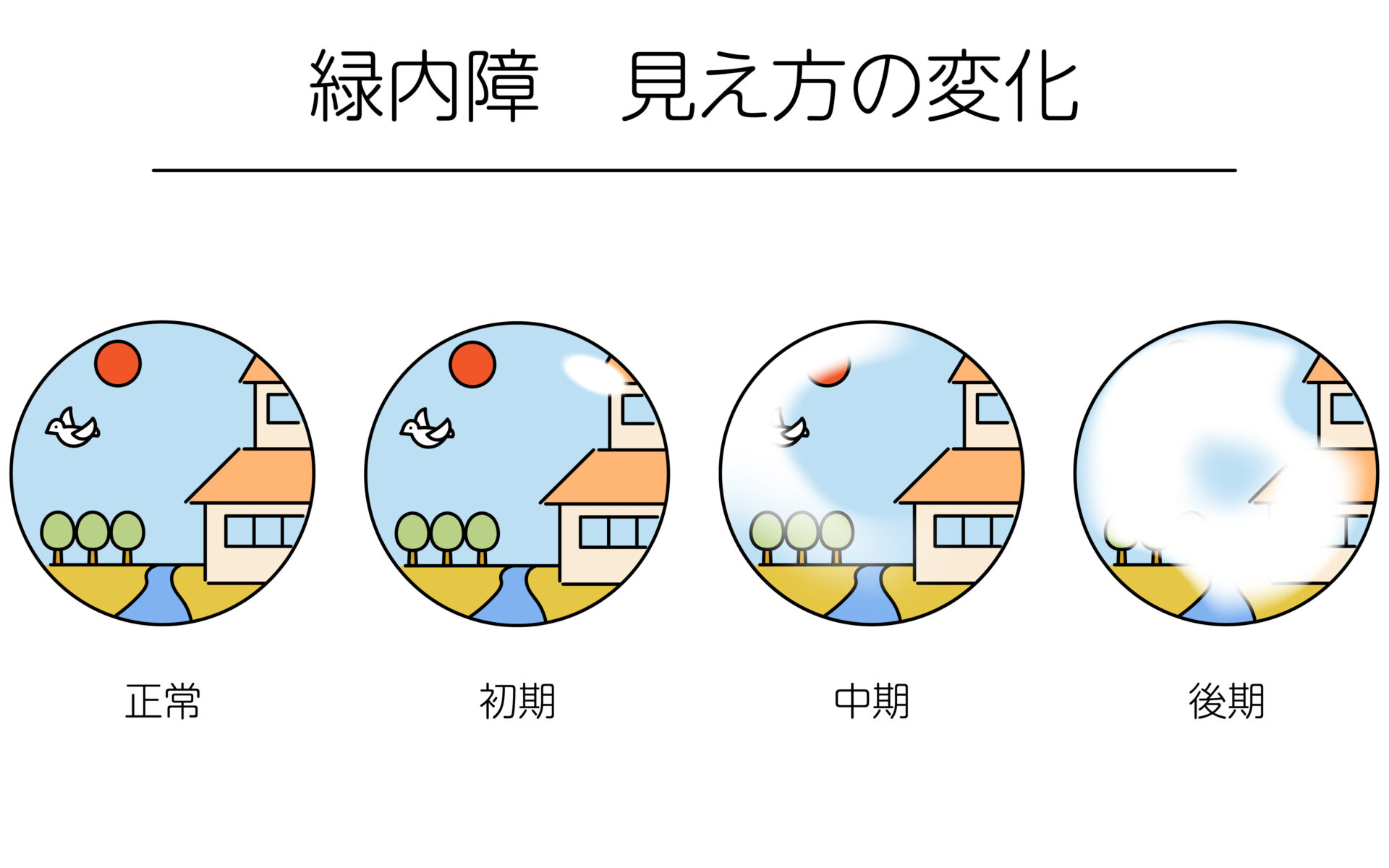 Amazon.com: 眼科スゴ技 緑内障の診断・治療・手術: WEB動画付き